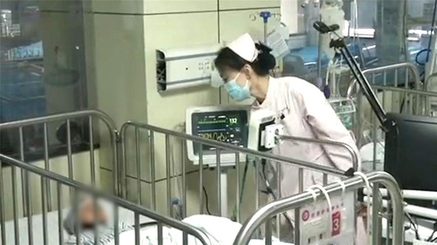4岁女童患热射病致多脏器功能衰竭