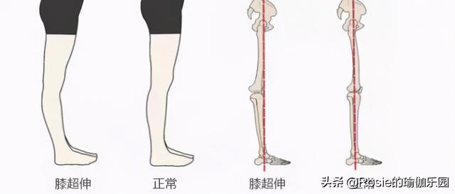 奚夢瑤懷二胎？孕期產後注意這2點，遠離水桶腰大象腿不腰痛 健身減肥達人 第16张