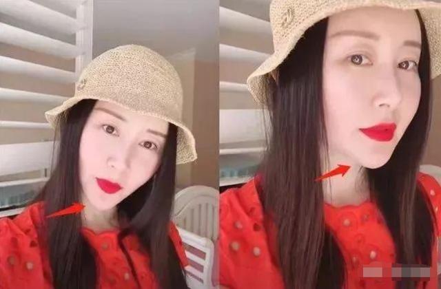 曾是超女總冠軍，如今整容失敗像「怪物」，只有眼珠是自己的 娛樂八卦吃瓜 第17张