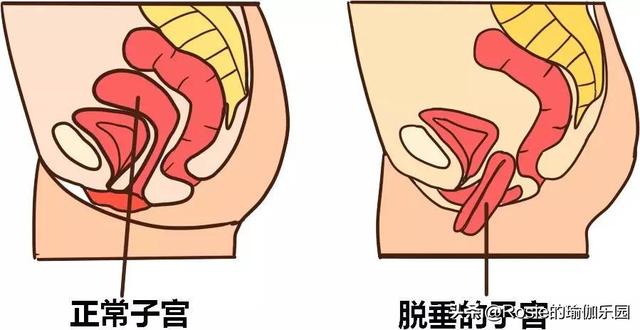 38歲備孕3年，林依晨順利產女，產後盆底肌鬆弛、漏尿如何做？ 健身減肥達人 第8张