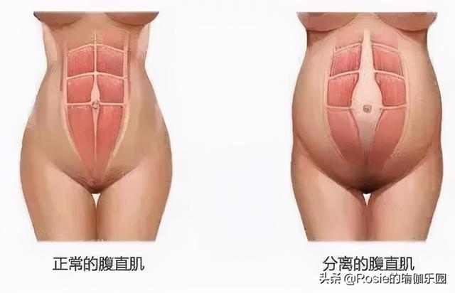 怒甩豪門消失7年，39歲陳法拉產女，產後瘦肚子如何不踩坑？ 健身減肥達人 第20张