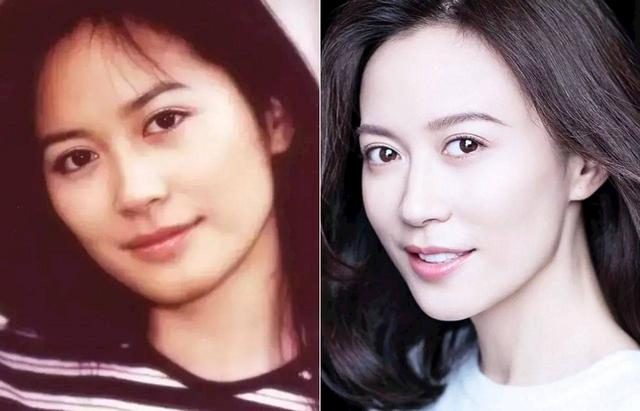 青春期方脸怎么变瓜子脸，如何改善方脸变成瓜子脸（5个妙招让你分分钟变瓜子脸）