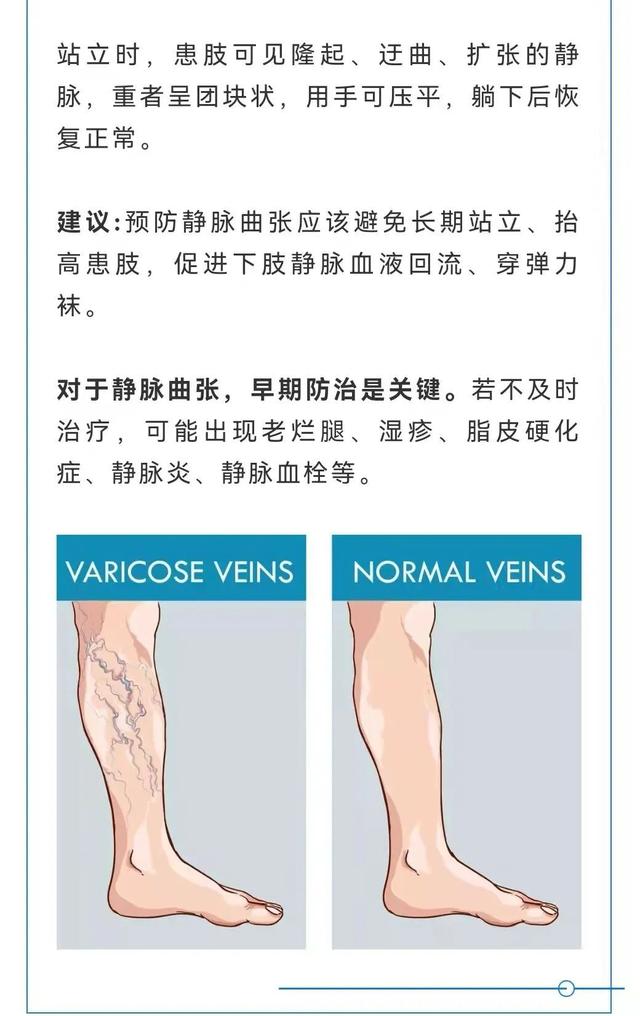 做梦开车撞死人(做梦开车撞死人了是什么征兆)插图4