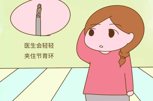 上环的手术是如何进行的?