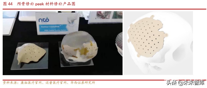 骨科行业深度报告：水大鱼大，老龄化与政策驱动