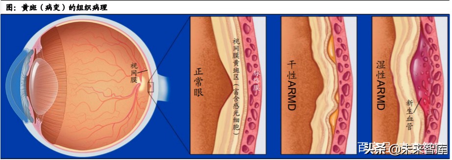 眼科產業鏈深度報告：創新驅動，服務為王