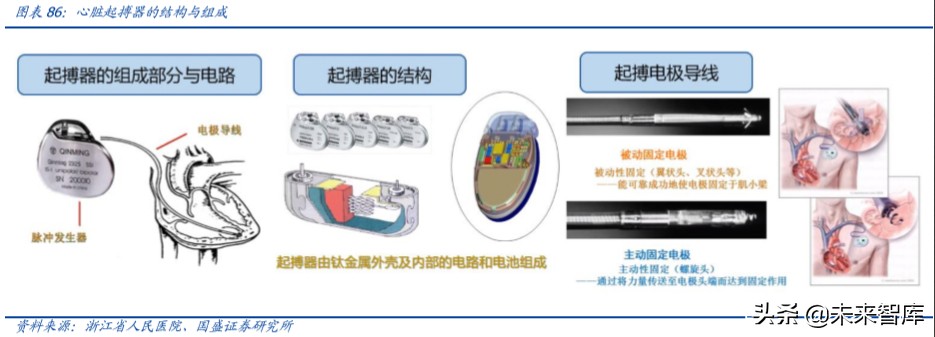 乐普医疗深度解析：布局心血管医疗全产业链，不断创新发展