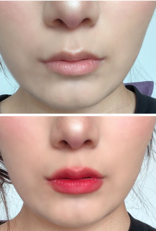 嘴唇厚怎么改善嘴唇薄的女人刻薄