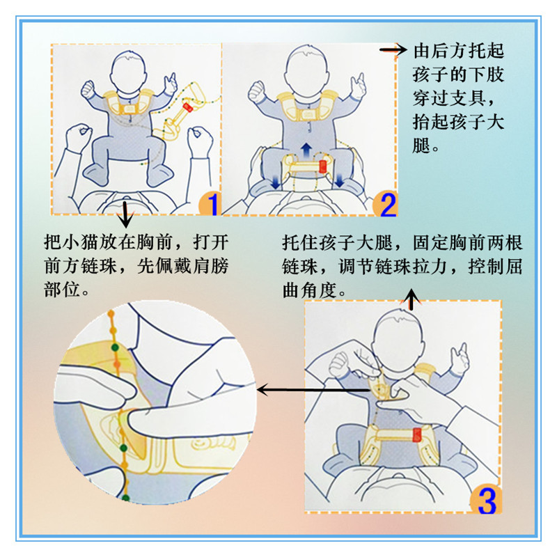 换尿布时大腿根有异响?有可能是髋关节脱位