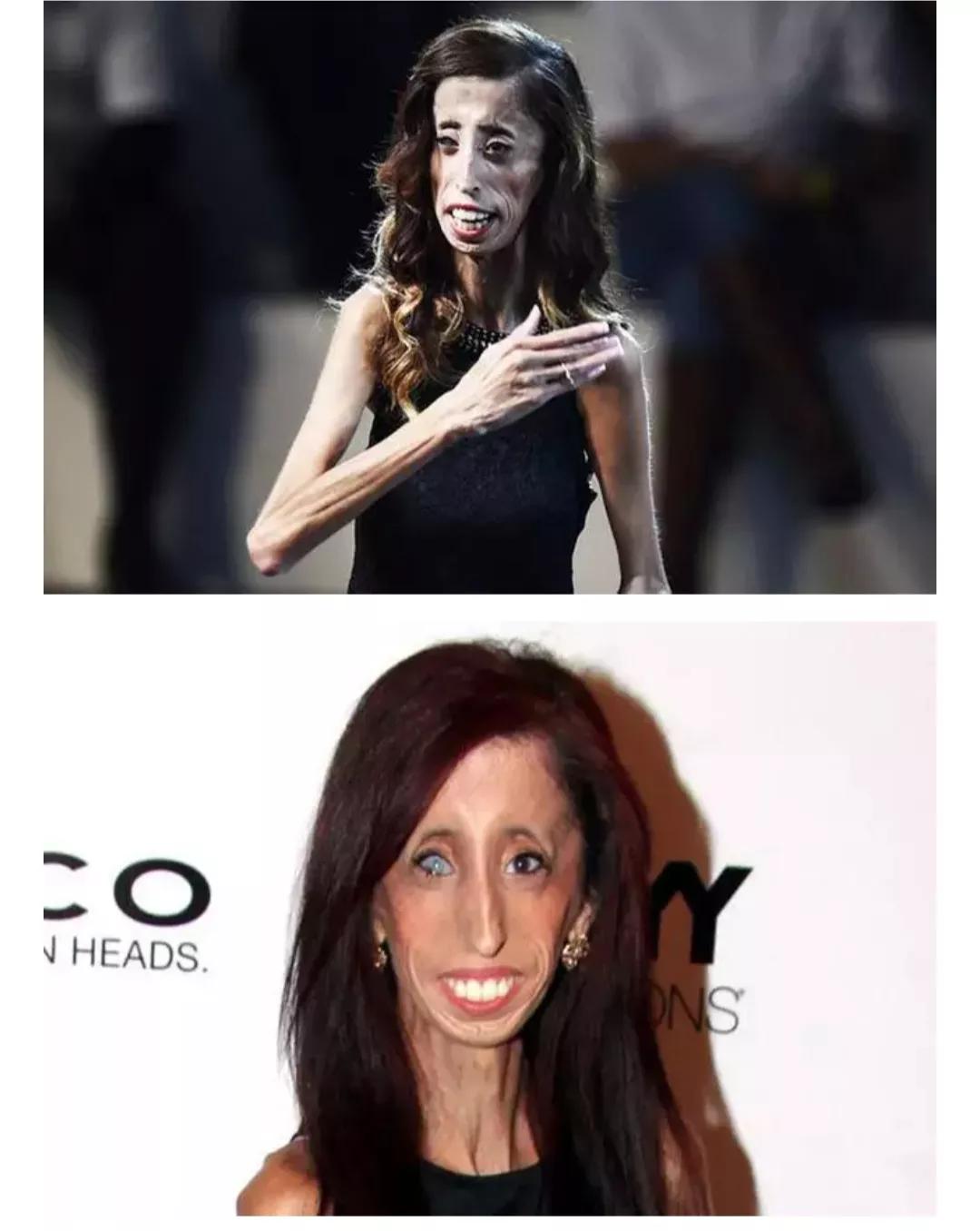 话说,今天要讲的故事的主人公叫丽兹61贝拉斯克斯(lizzie velasquez