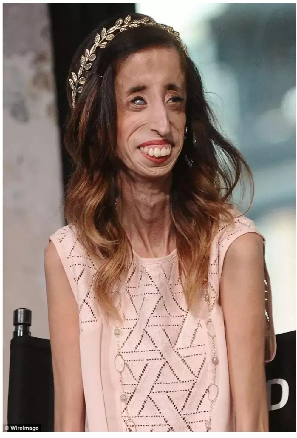 话说,今天要讲的故事的主人公叫丽兹61贝拉斯克斯(lizzie velasquez