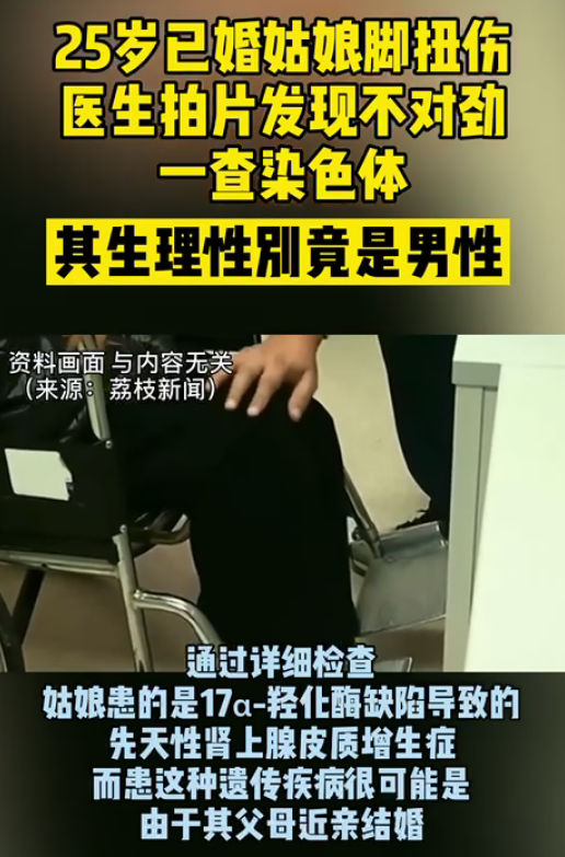 扭伤|女子脚踝扭伤被查出是男性 从小到大没来过一次大姨妈