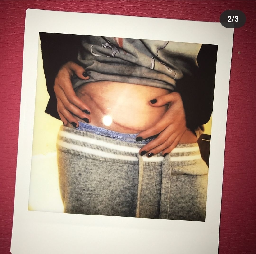 控诉|赛琳娜粉丝控诉明星大侦探P图 节目组这件事道歉了