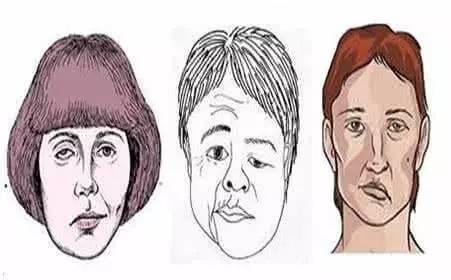 左眼跳是什么预兆,左眼跳小心是这4种疾病