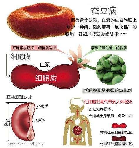 蚕豆病是怎么回事？会不会影响生长发育？怎么预防？一文告诉你1