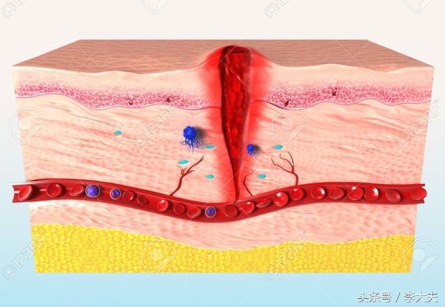 综合动态-脂肪层断裂怎么恢复(脂肪层能完全再生吗)-精美文章网