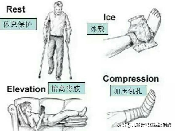 脚扭伤怎么处理