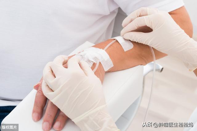 病人检查放疗是什么意思 病人检查放疗是什么意思
