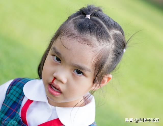 小儿流鼻血花费将近千元，却查不出病因？是否存在滥开检查？