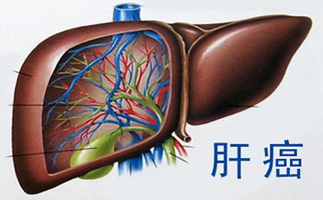 3种蔬菜已被列入伤肝“黑名单”，希望大家及早远离