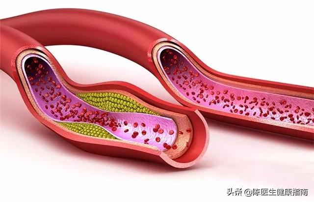 高血压补叶酸，吃多长时间合适？同型半胱氨酸高，多长时间复查？