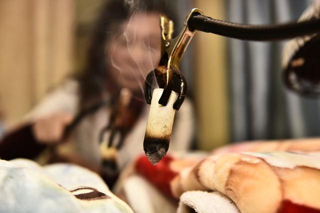 风湿和类风湿用艾灸可以治好吗？可以缓解关节的疼痛感