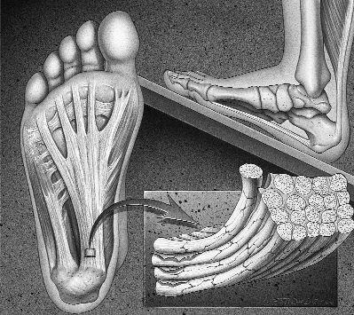 足底疼痛位置图,足底疼痛位置图片