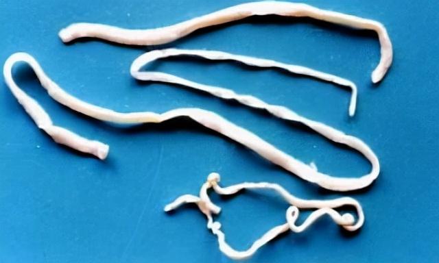 猫寄生虫感染的治疗方法(人感染猫寄生虫怎么治)