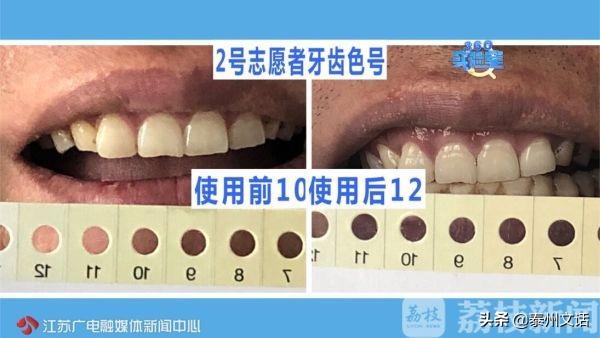 白牙素