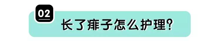 长痱子能涂身体乳吗