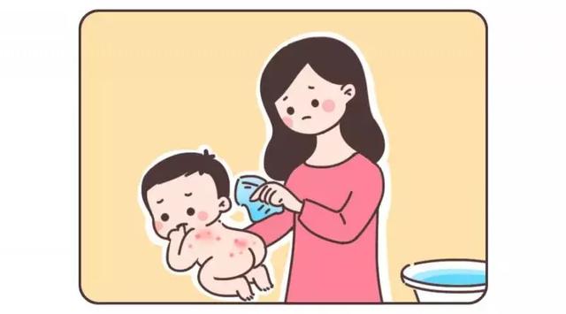 长痱子能涂身体乳吗