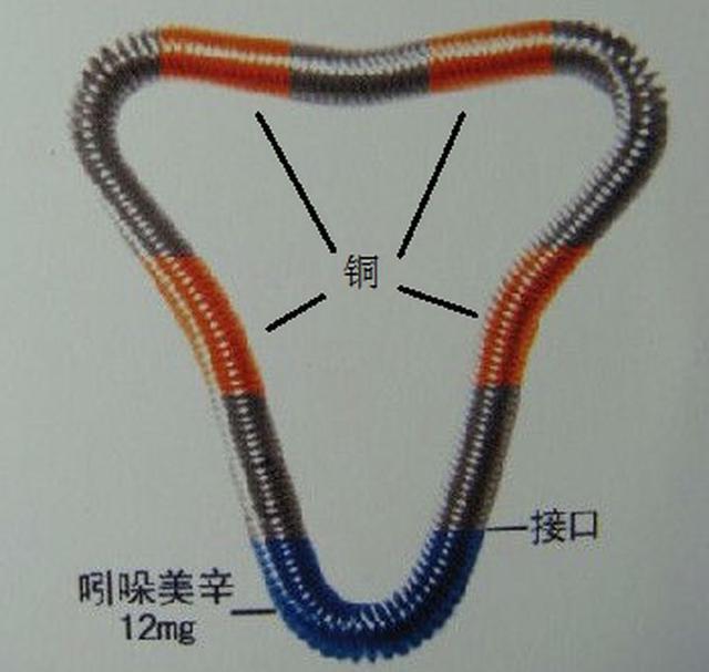 工型避孕环图片