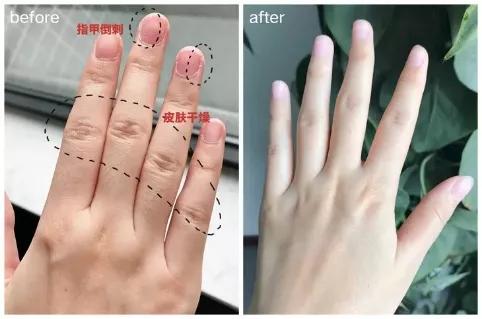 涂身体乳很痛怎么回事