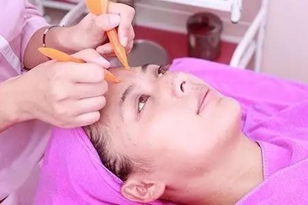 怎么去掉悬针纹小妙招（悬针纹怎么形成的）