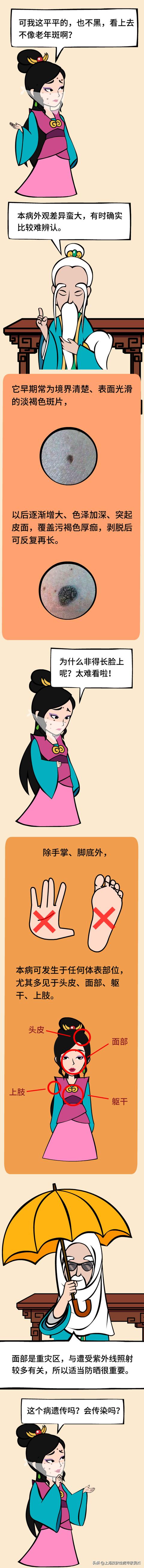 年轻人得脂溢性角化病