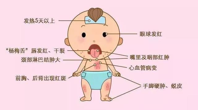 皮肤发红全身起鸡皮
