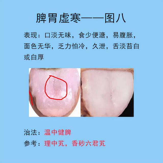 脾胃常见的10种舌象，以及临床表现，后面带解决方法
