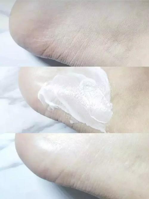身体乳使用年龄