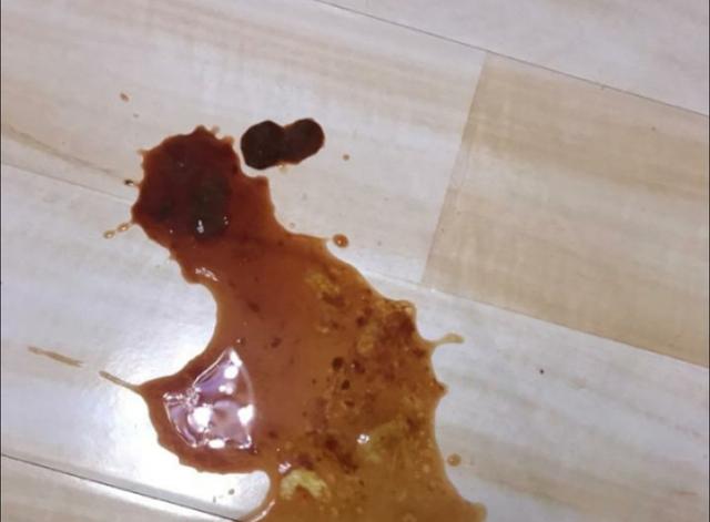 细小潜伏期