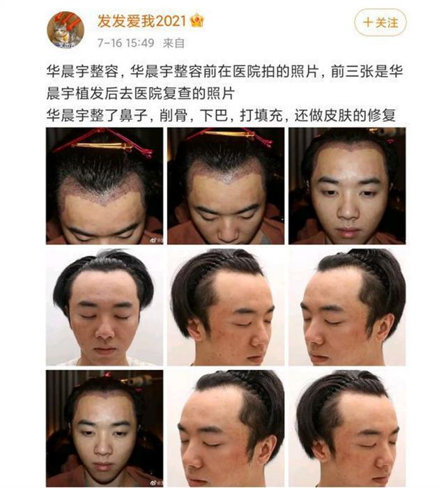 一个名叫"发发爱我 2021"的网友连续在网上爆了华晨宇的料,从整容