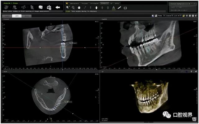 孩子拍牙片会损伤智商？真相是？
