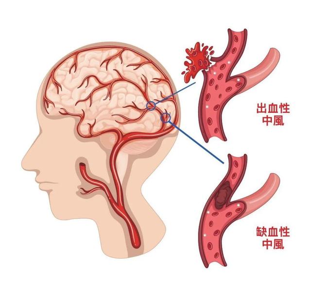 现代药理学及古中医对巴戟天的认识