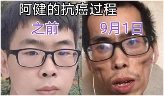 抗癌网红阿健病逝，120万的“抗癌针”何时普及？网友：等官宣