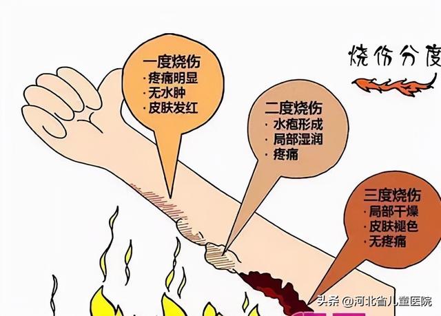 烫烫烫，烫着了！我们来帮您