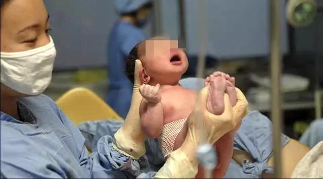 一定要记得给宝宝采集足跟血，进行新生儿疾病筛查