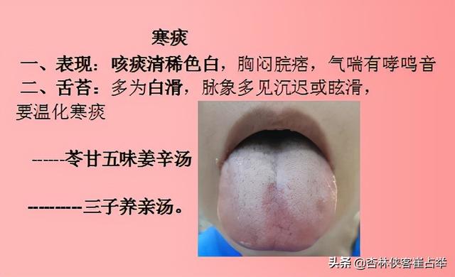 痰在肺则咳，痰在胃则呕！五种痰证的表现和治疗你知道多少？