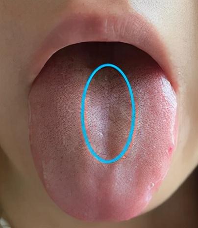 气虚了？是脾气虚、肺气虚还是肾气虚？各种气虚如何补？