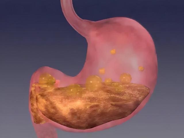 消化科医生：胃不好，起床后少做3件事，胃病或会慢慢好转