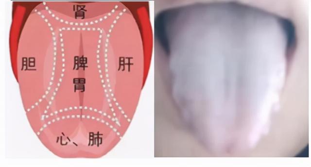 中医教你看舌诊，这几种情况要注意