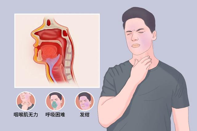 聊一味中成药，专为伤脾胃的办公文弱一族补中益气